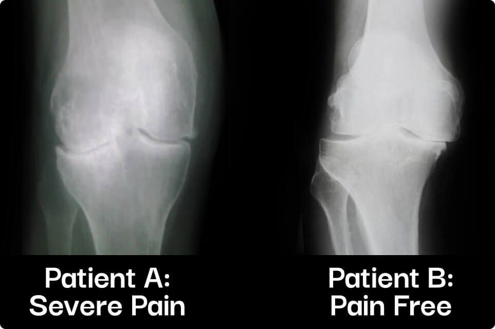 xrays from two different patients